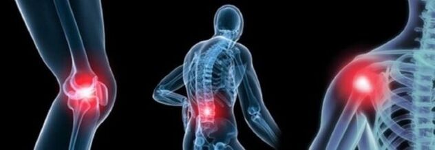 Types of pain with osteoarthritis