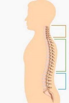 Lesion of the osteochondrosis of different parts of the spine