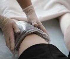 Ozokerite applications on the knee for osteoarthritis