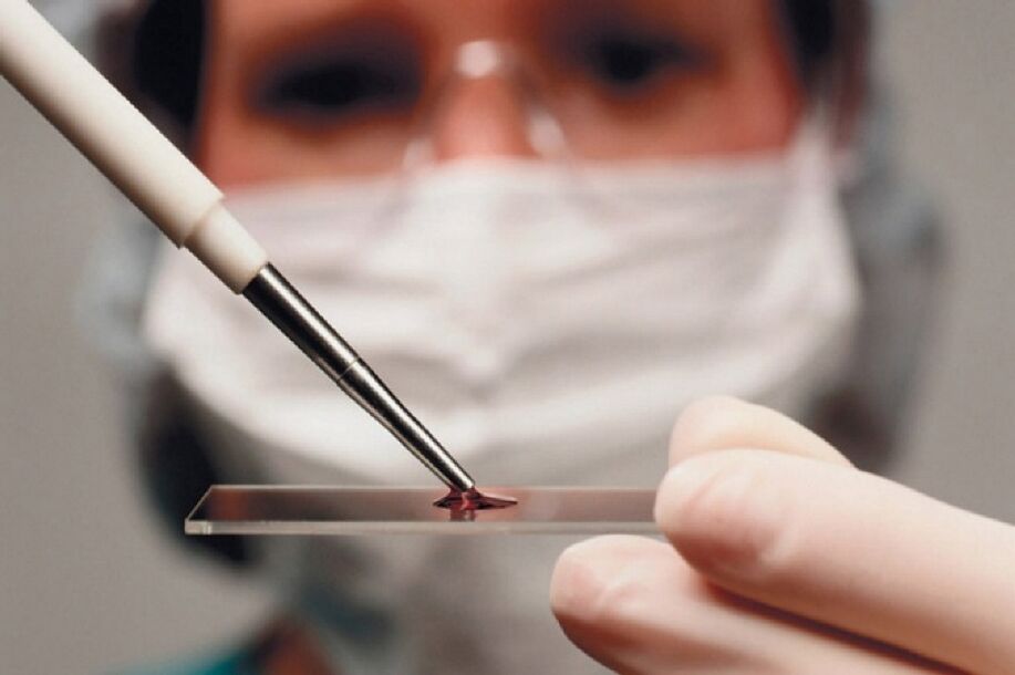 Arthritis is an inflammatory disease whose presence is determined through blood tests.
