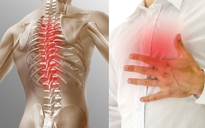 Thoracic osteochondrosis manifests itself as pain and a feeling of tightness in the chest