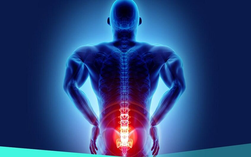 Pain due to hip osteoarthritis